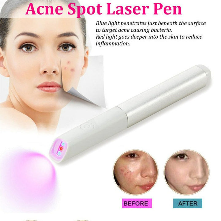 Acne Treatment Light Therapy Pen - Clear Skin Fast
